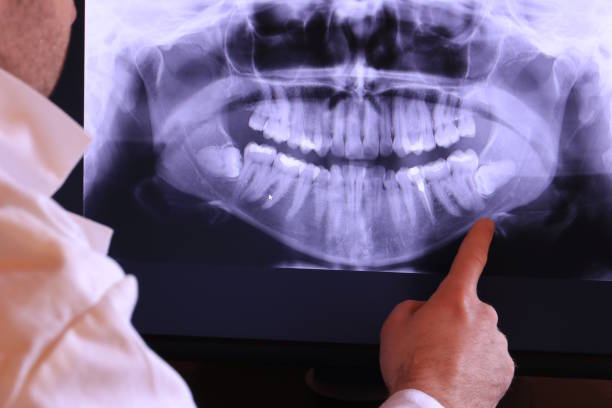 Best Emergency Treatment for Jaw Pain or Injury in Robinson, IL