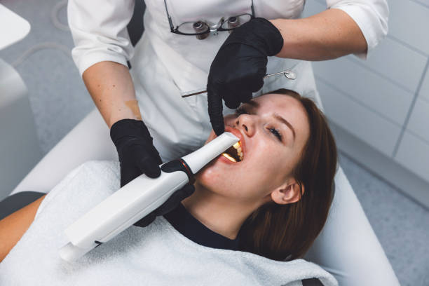 Best Knocked-Out Tooth (Avulsed Tooth) Treatment in Robinson, IL